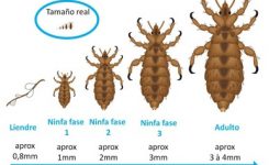 ¿Dónde viven los piojos cuando no están en la cabeza? ¿Cuánto sobreviven los piojos?